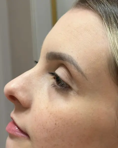Antes do full face, de perfil