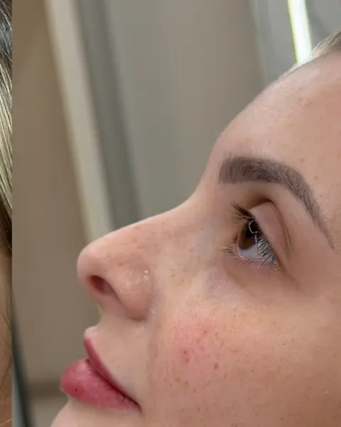 Depois do full face, de perfil, com contorno mais delicado